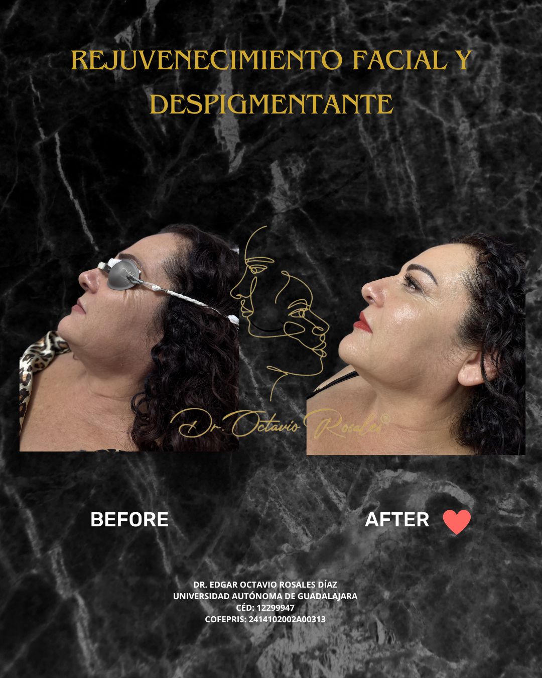 Edgar Octavio Rosales Diaz-19