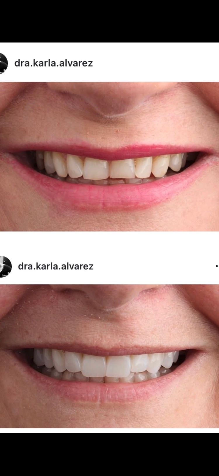 Karla Alvarez Treviño-1