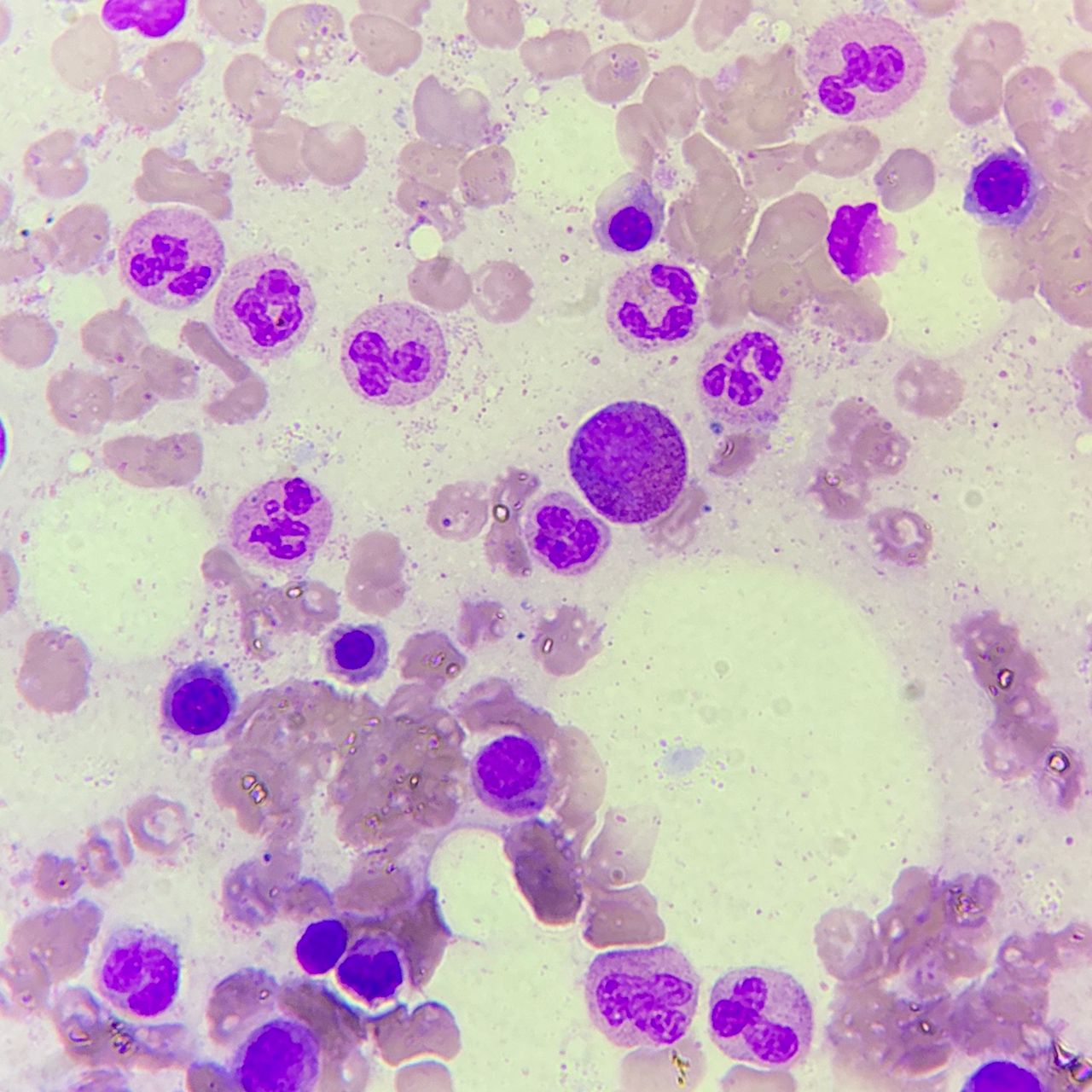 Víctor Pérez Hernández-1