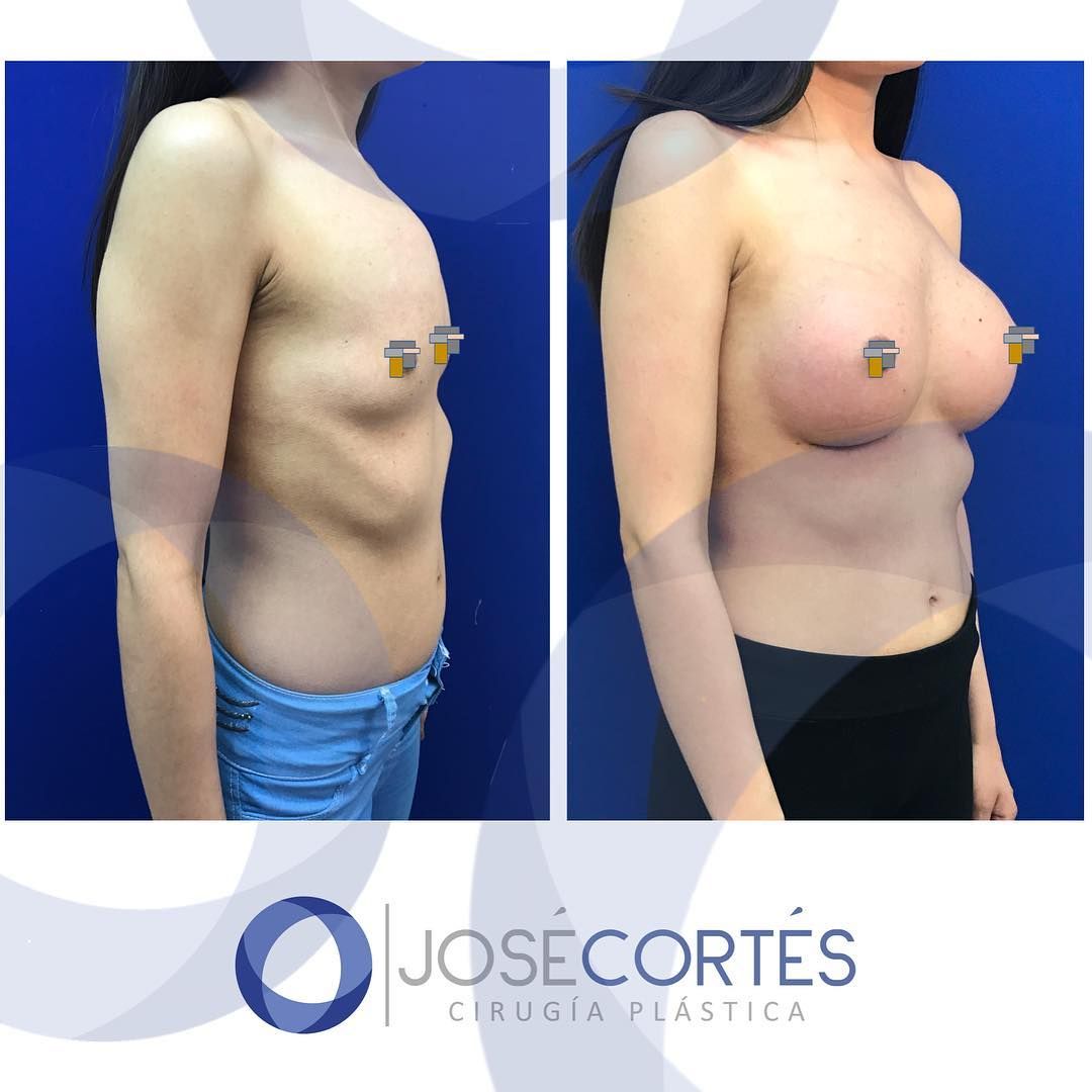 José Cortés Arreguin-30