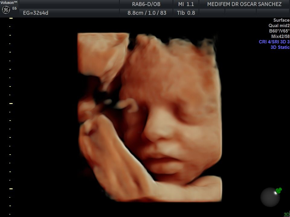 Oscar Alejandro Sánchez Gámez-5