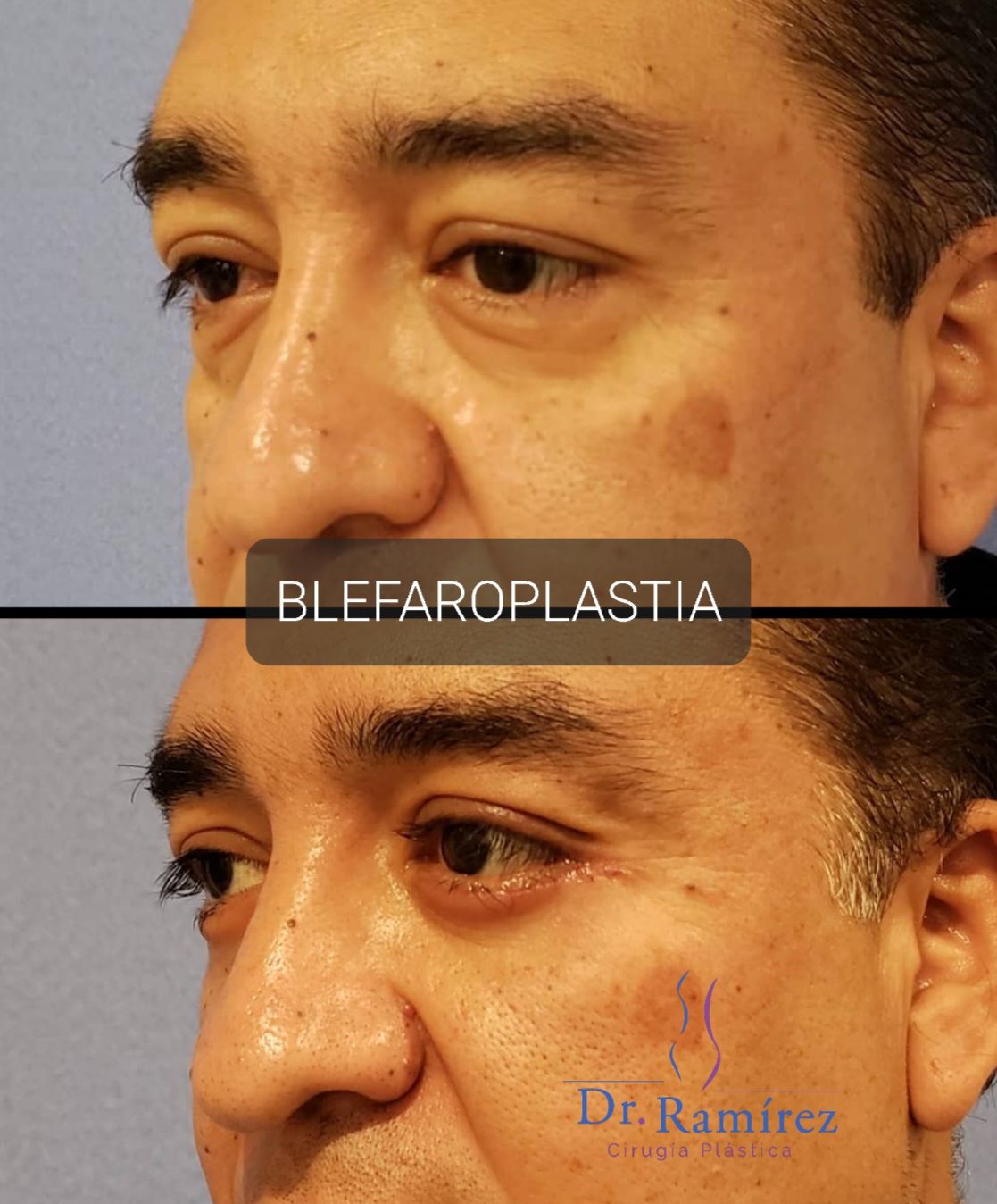 Edgar Ramírez López-17