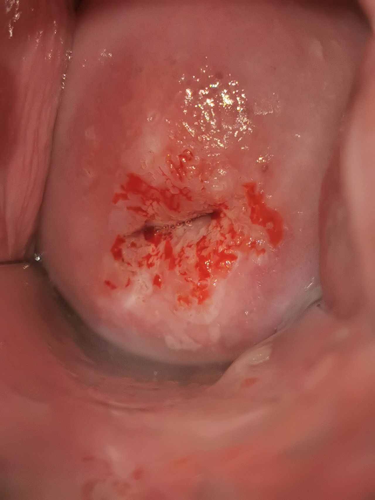 Marisol I. Alvarez Carrasco-31