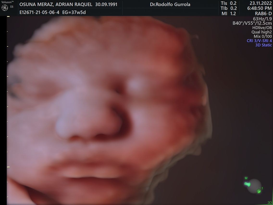 Rodolfo Antonio Gurrola Ochoa-6