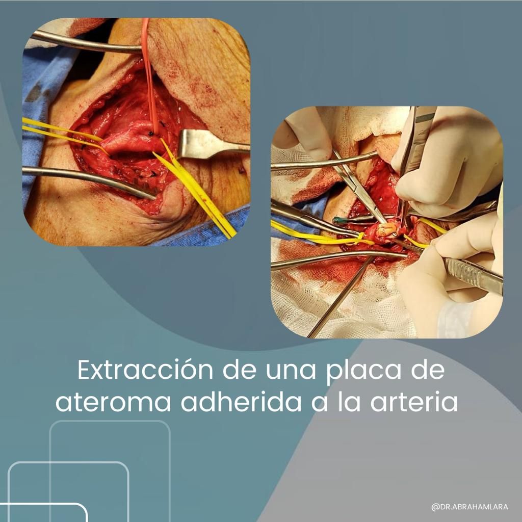 Miguel Abraham Lara Perez-19