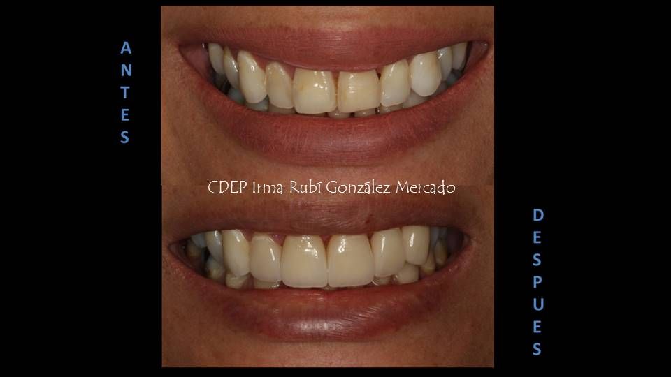 Irma Rubí González Mercado-2