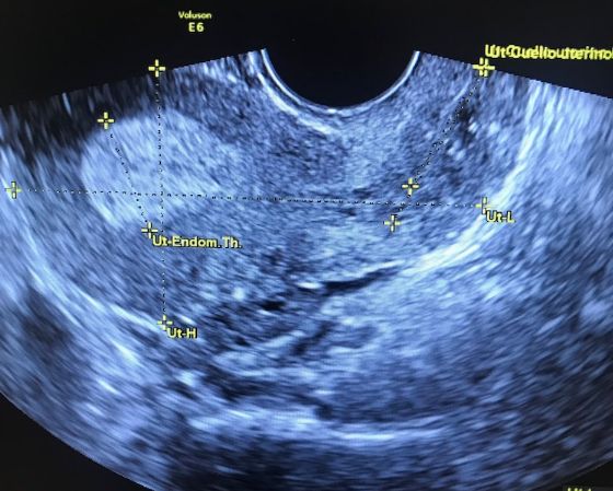 Griselda Reyes Torres-97