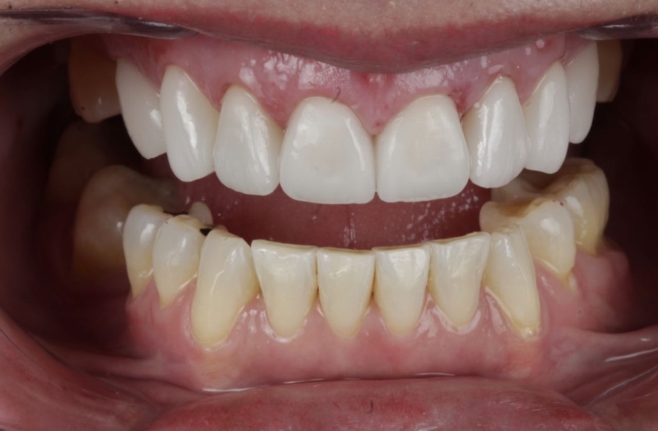 Yubel Díaz Arredondo-0