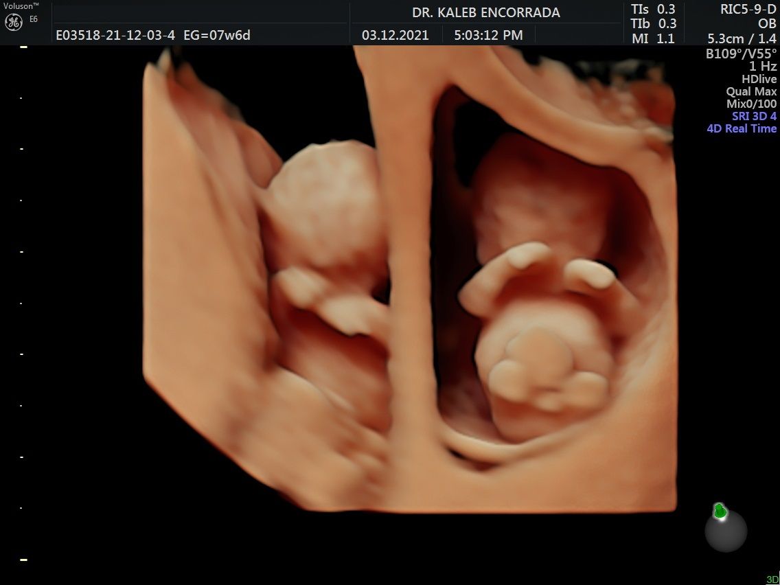 Hugo Kaleb Encorrada Luarca-18