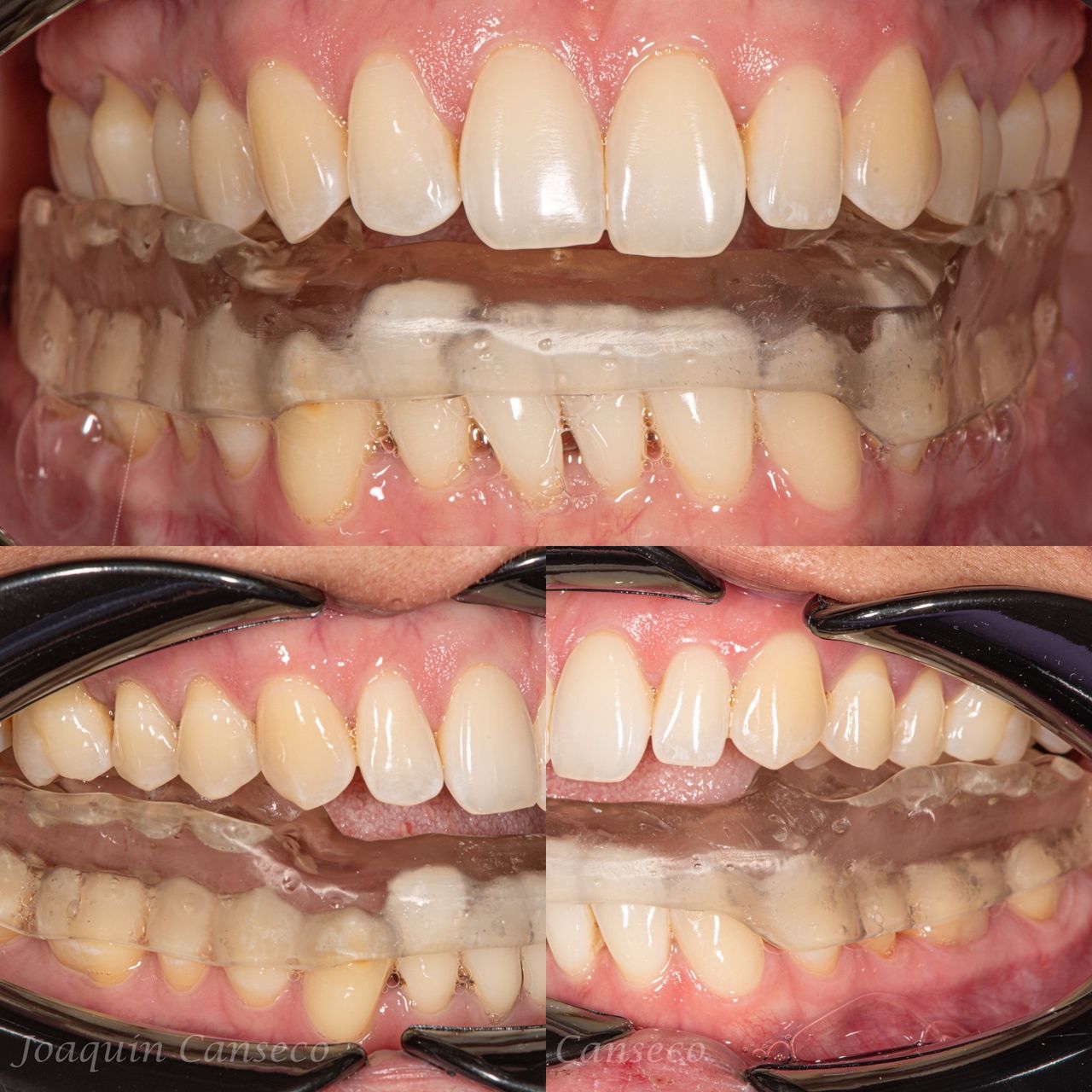 Joaquín Canseco Lopez-0