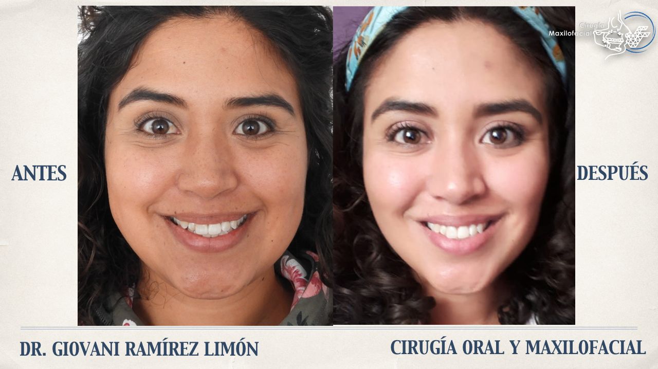 Giovani Ramírez Limón-42