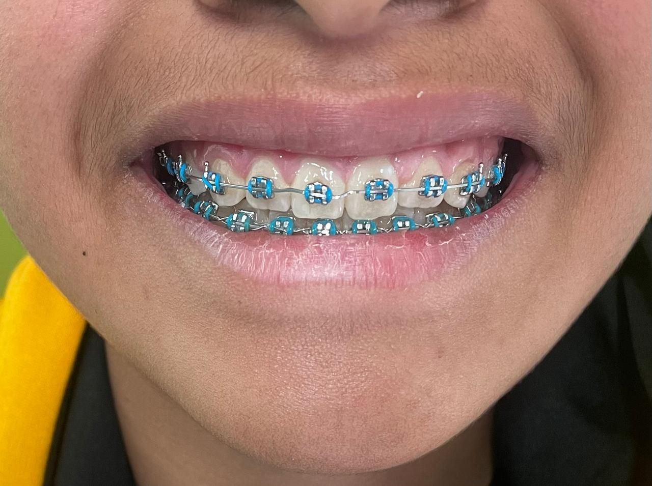 Anuar Becerril Castro-4