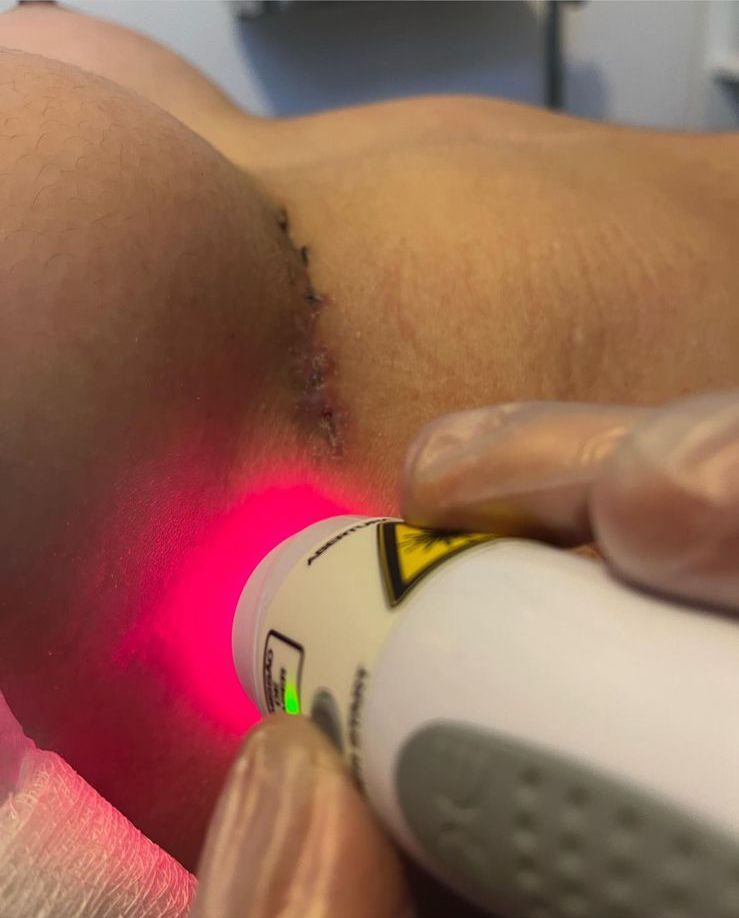 Marylin Bernabe Bernabe-25