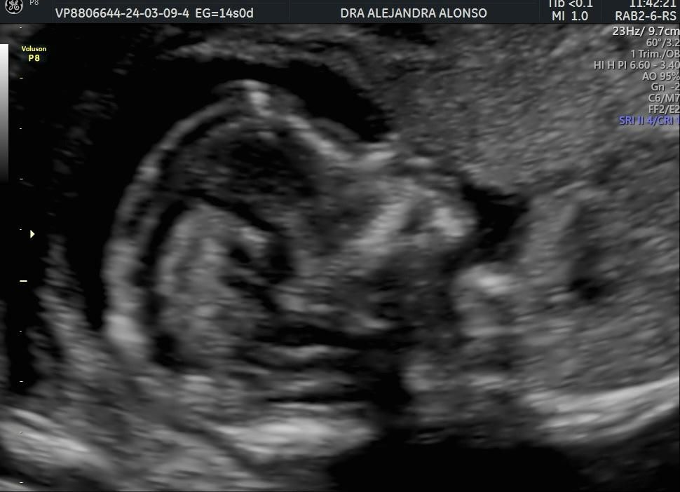 Alejandra Alonso Martínez-5