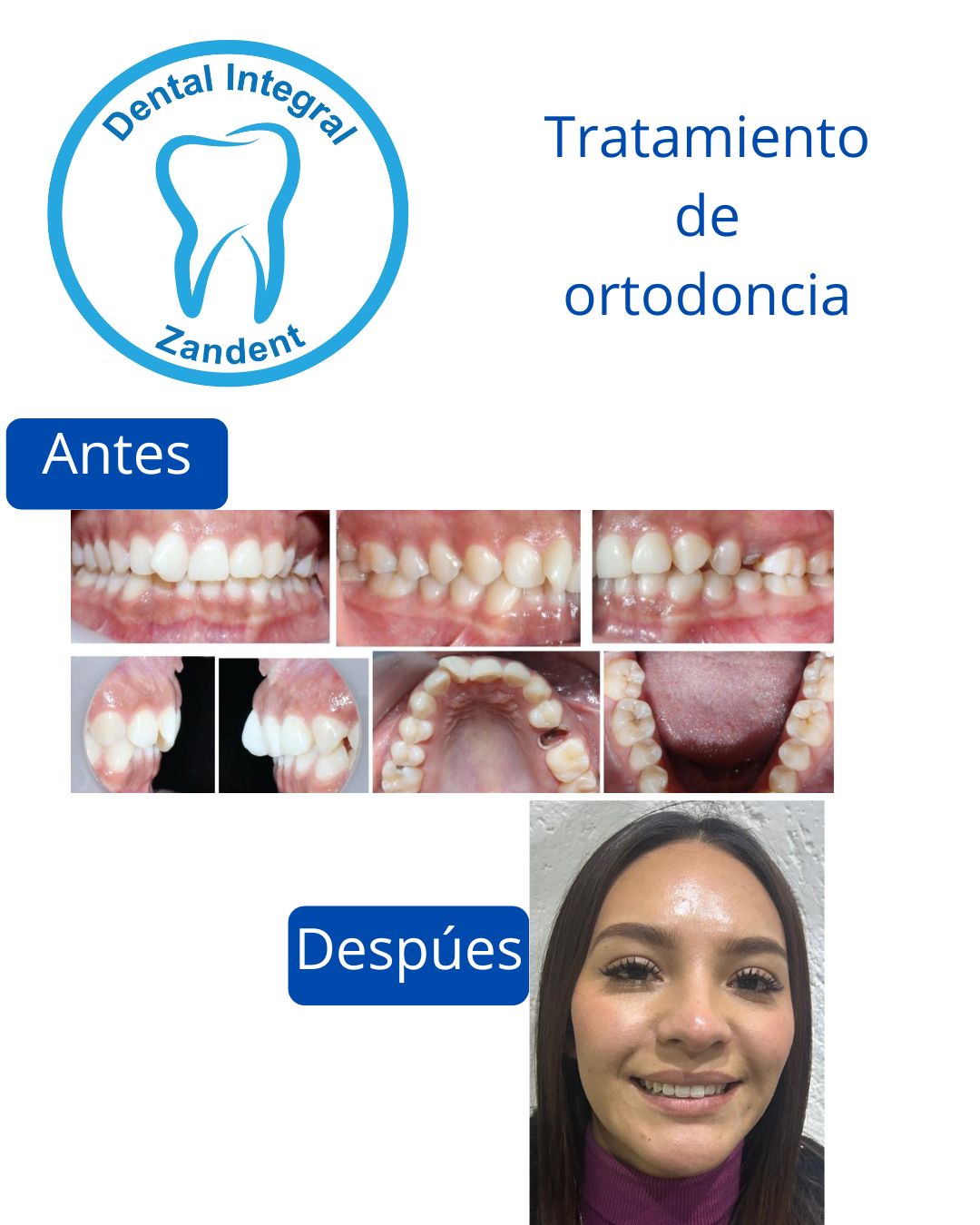 Zandra Moctezuma-1