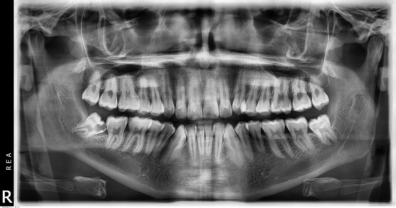 Dulce Areli  Chávez Sanabria -0