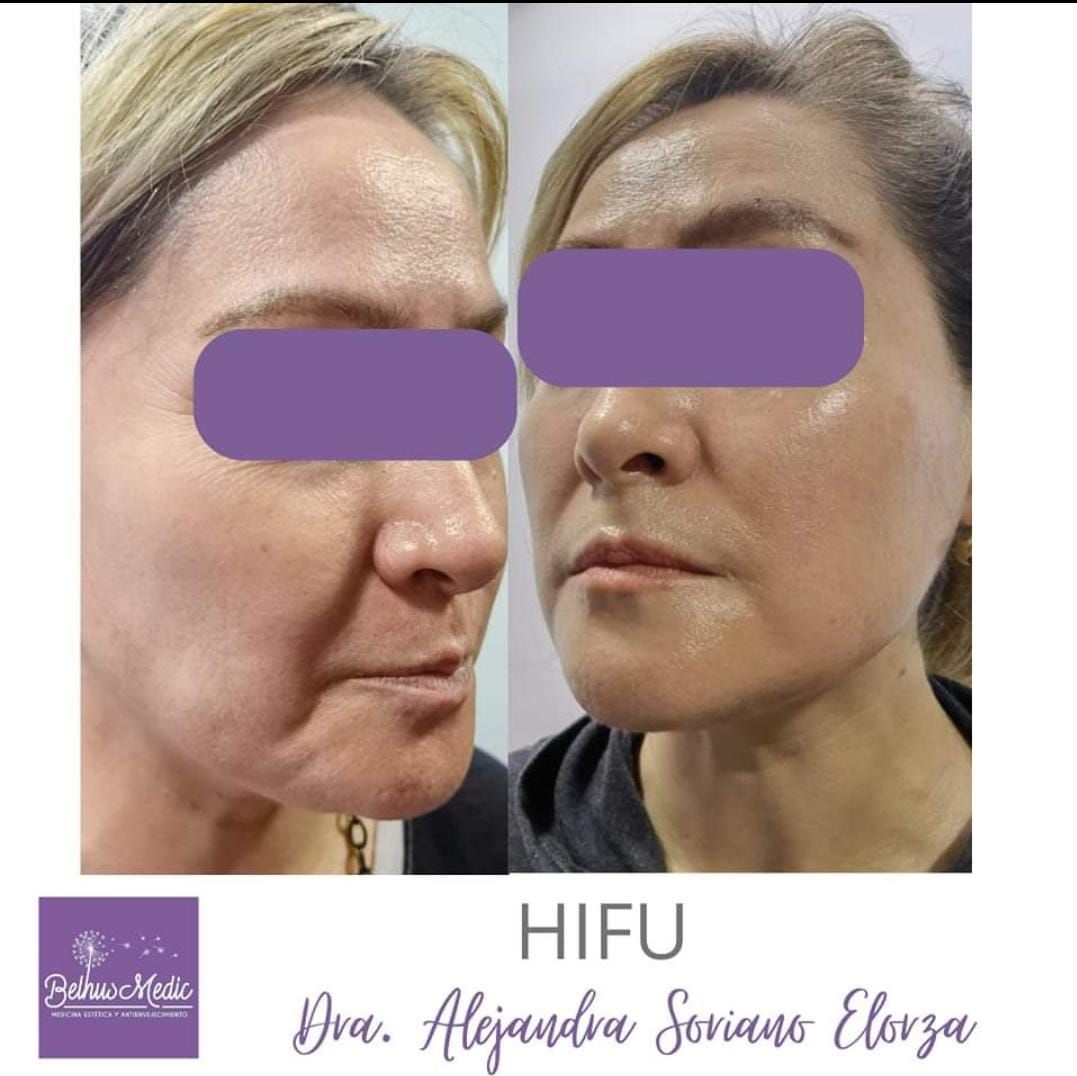 Alejandra Soriano Elorza-37