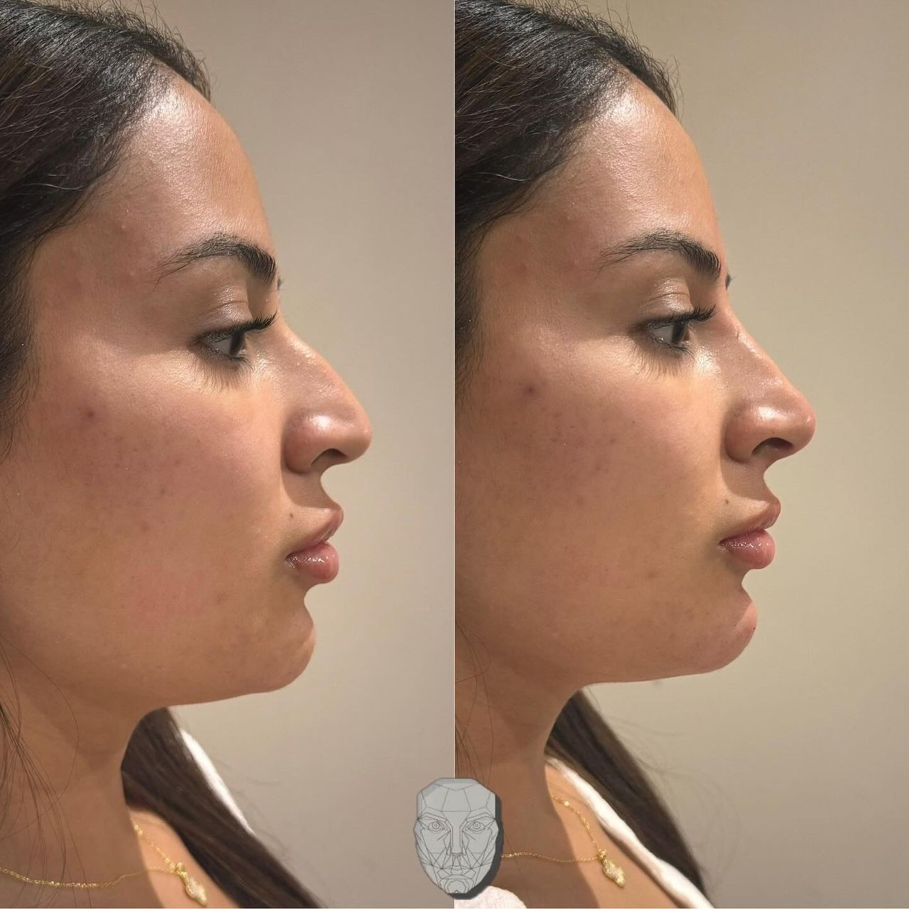 Anuar Hernández Flores-10