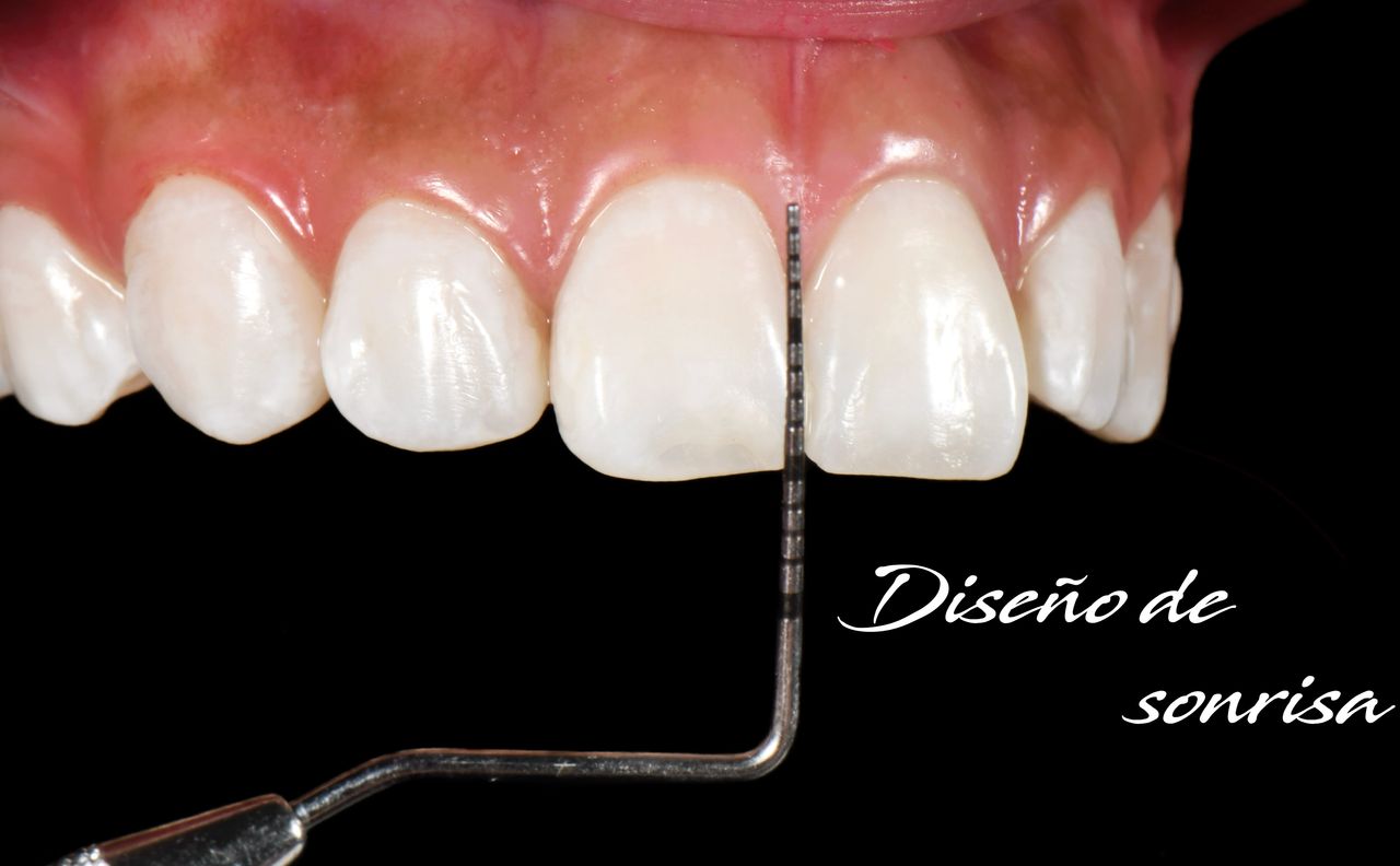 Josué Eli Ortiz López-0