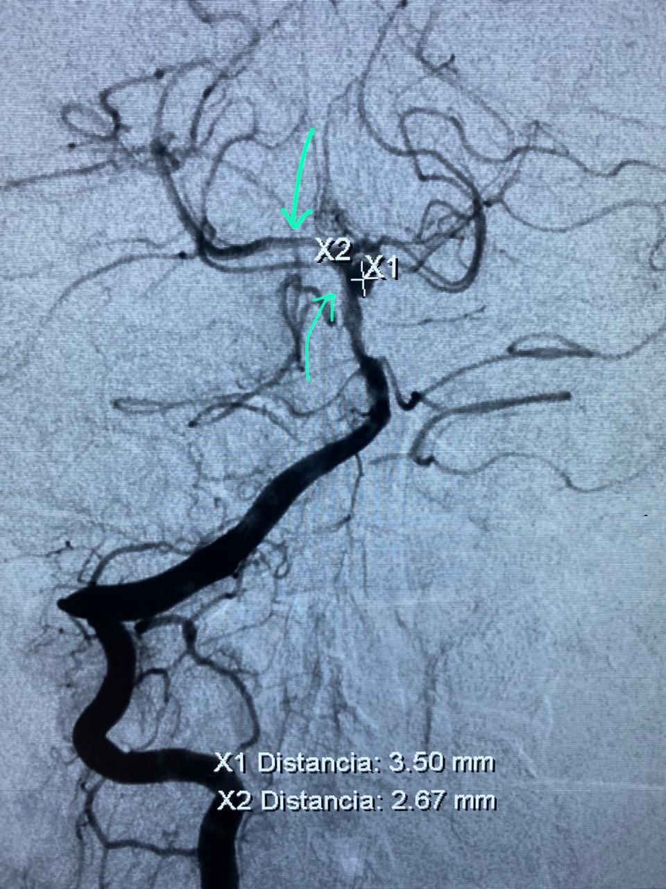 Edgar Fernando Acosta Gomez-6