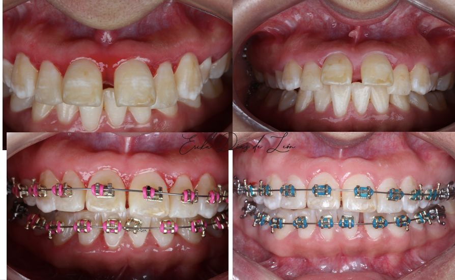 Erika Díaz De León Torres-6