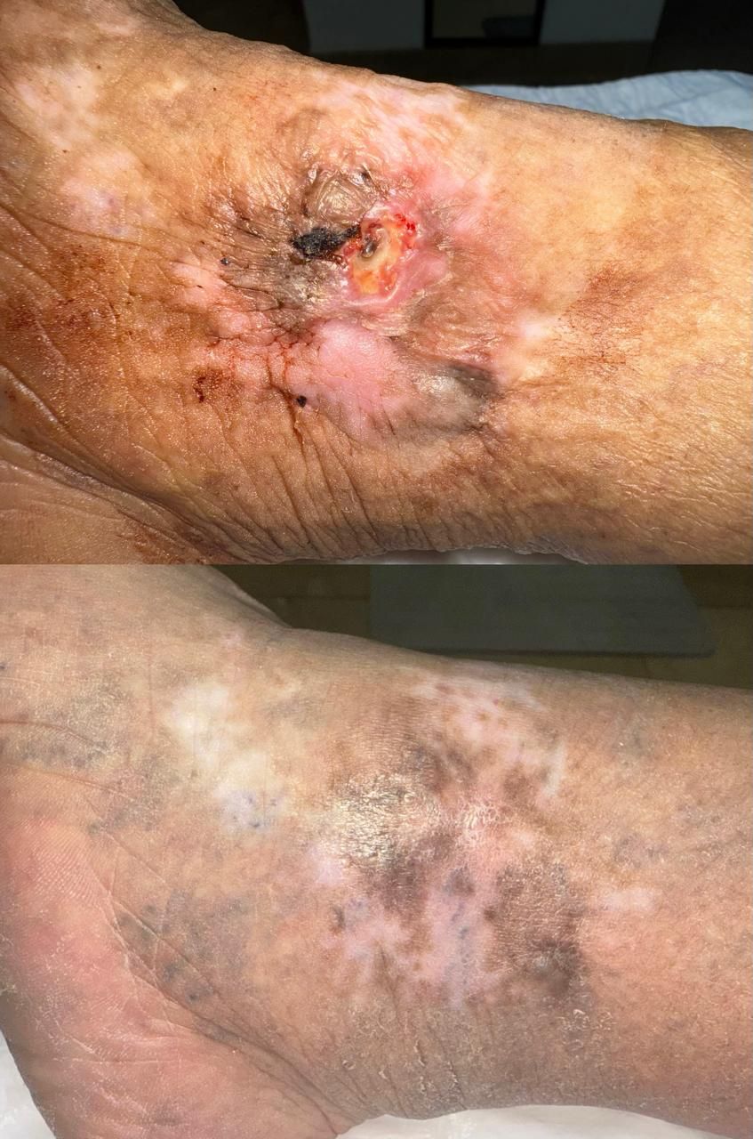 Jhonatan López González-72