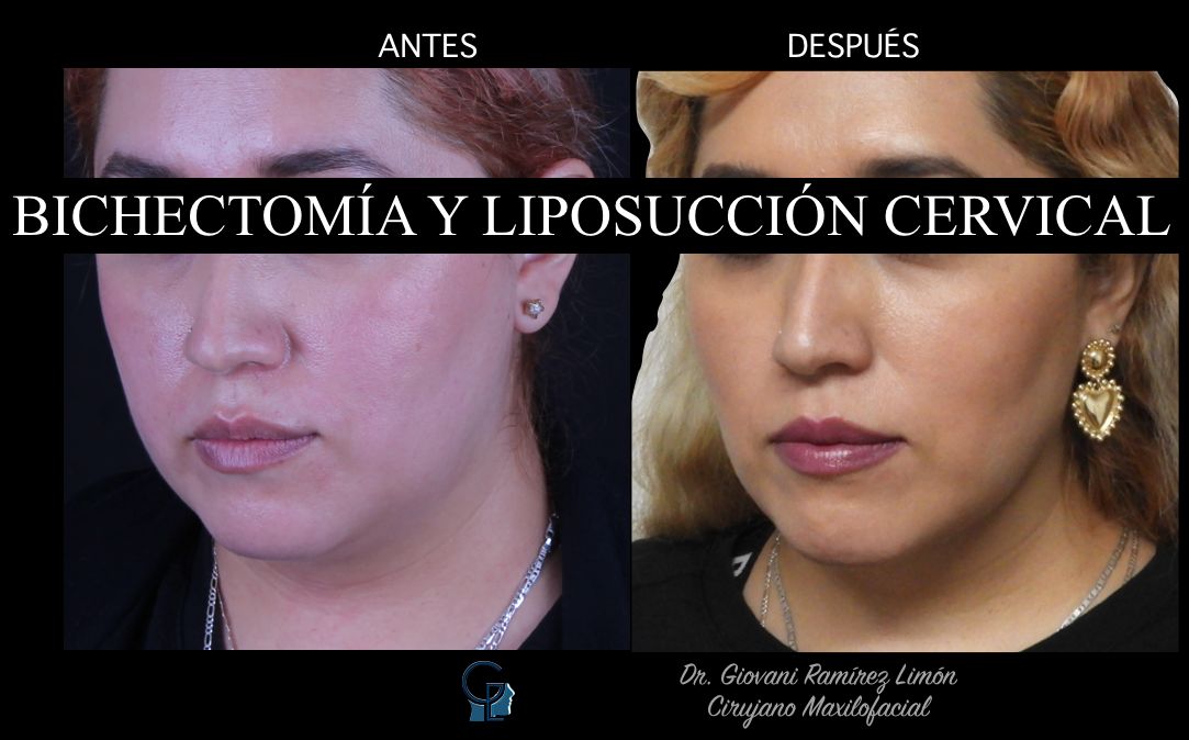 Giovani Ramírez Limón-20