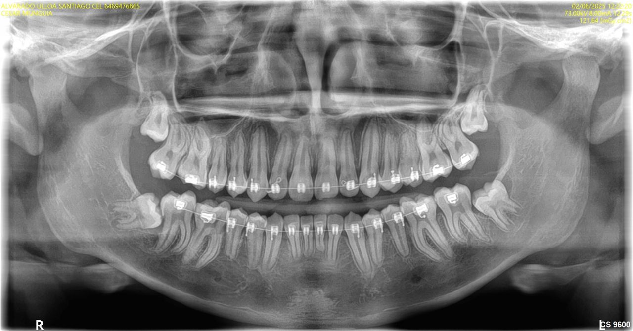 Ericka J. Hidalgo Vallejo-7