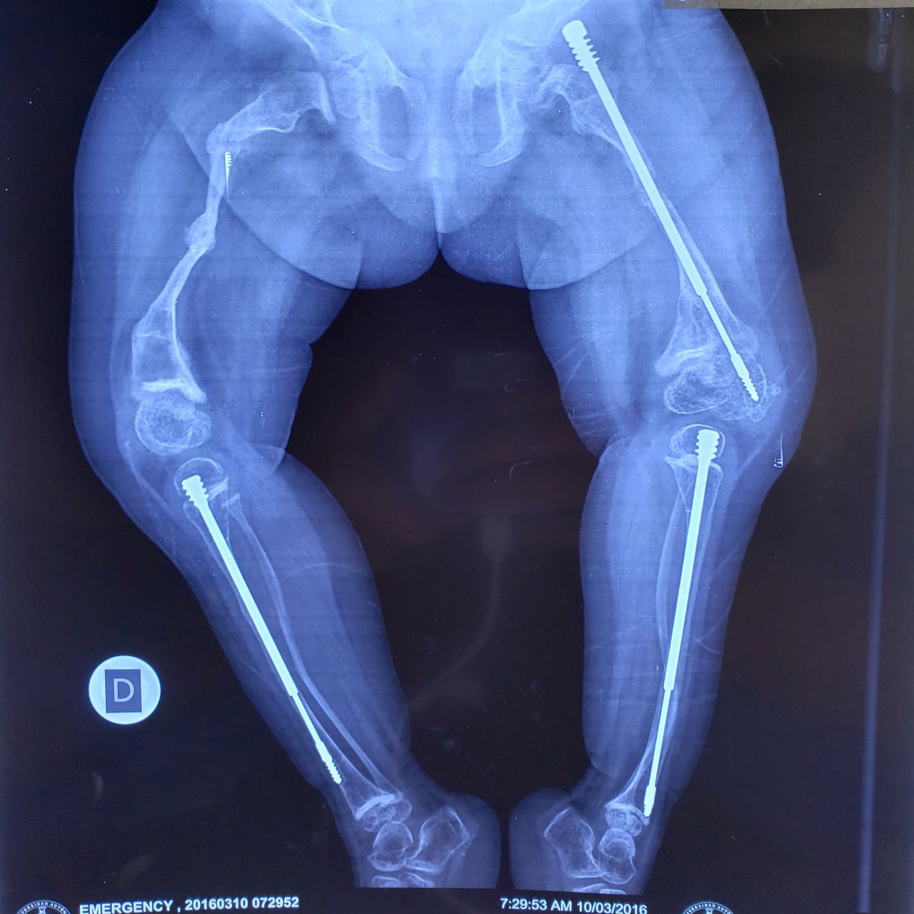 Alfonso Meza Vernis-90