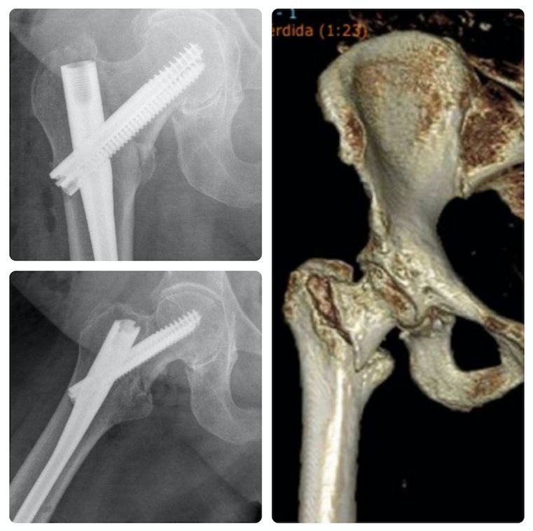 Luis Iram Lozano Parra-7