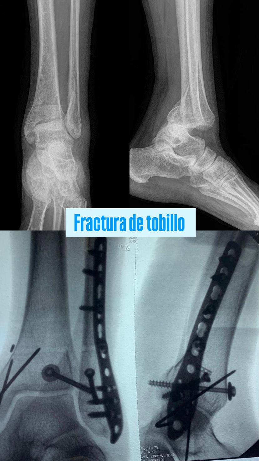 Juan Pablo Torres Nilo-3