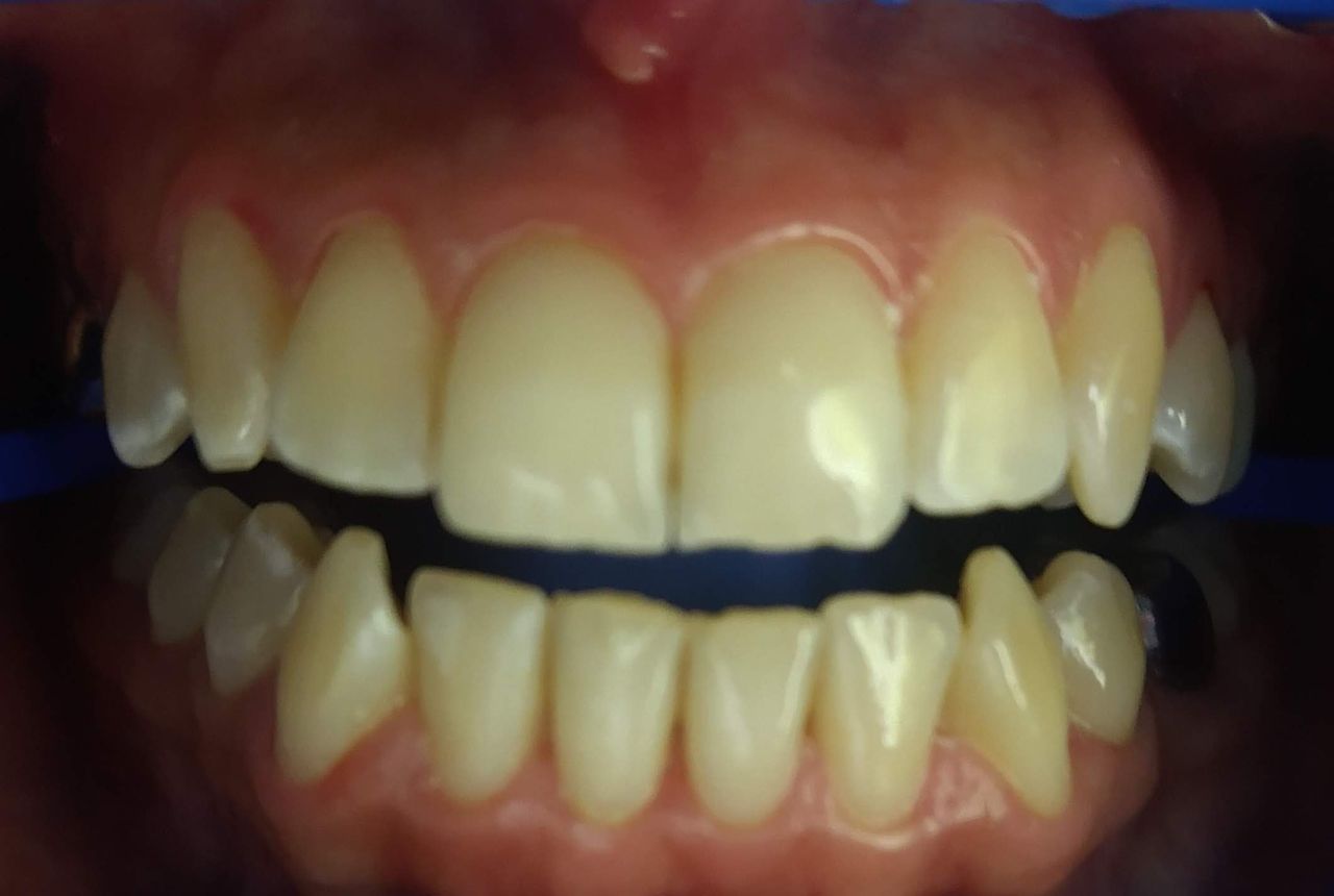 Petra Albarran Calzonzin-2