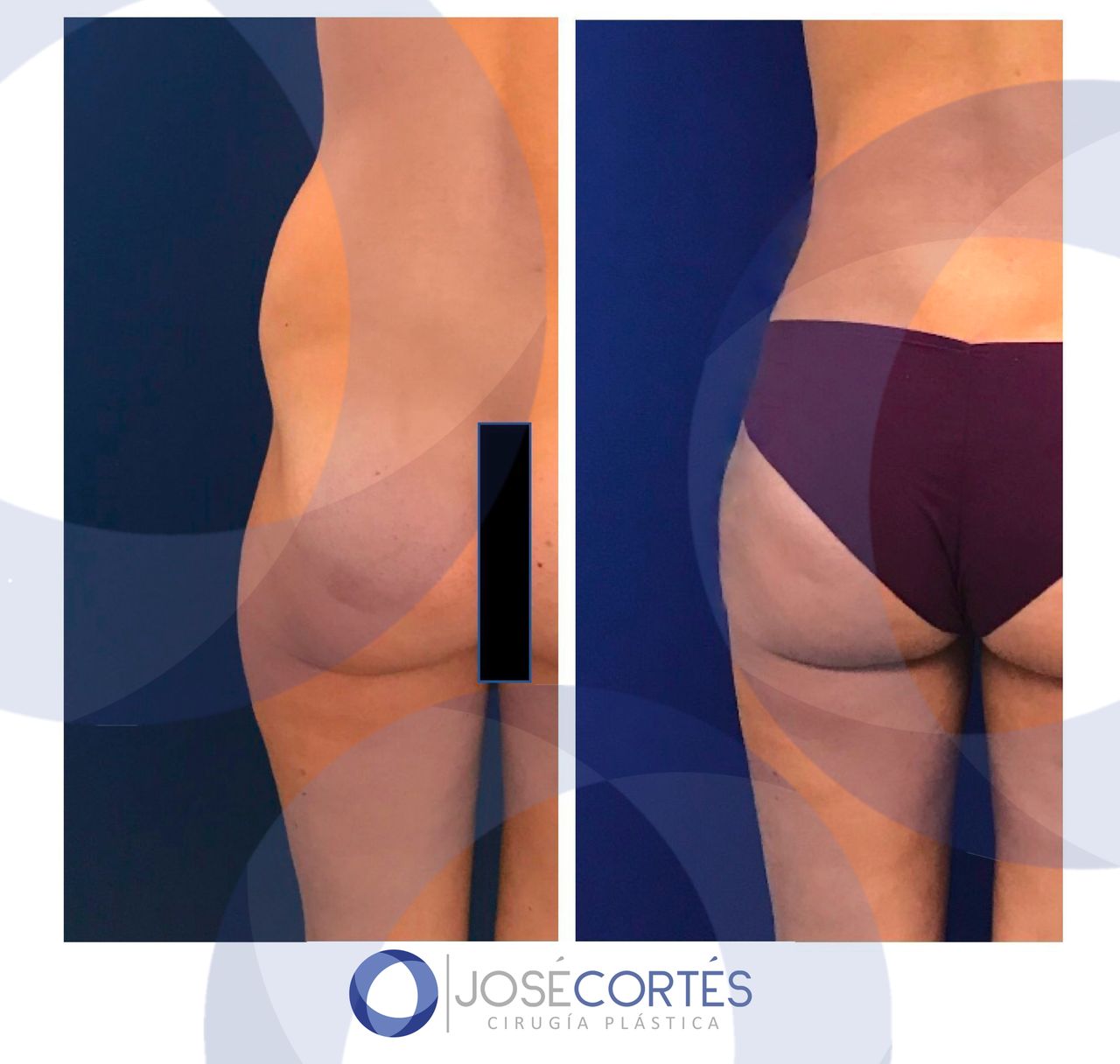 José Cortés Arreguin-31