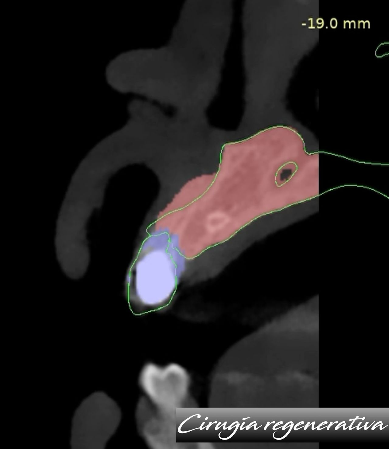 Josué Eli Ortiz López-9