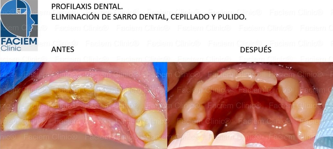 Arlen Colín Ordaz-28