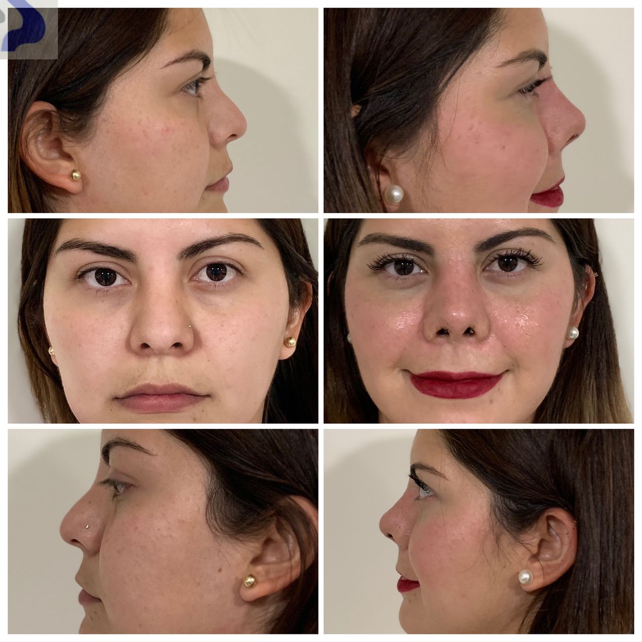 Cesar Alfonso Gutierrez Espinosa-10