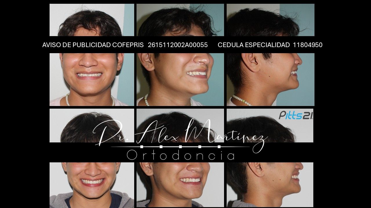 Alejandro Martínez Hernández-18