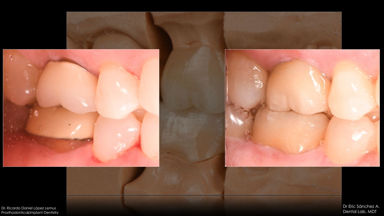 Ricardo López Lemus-37