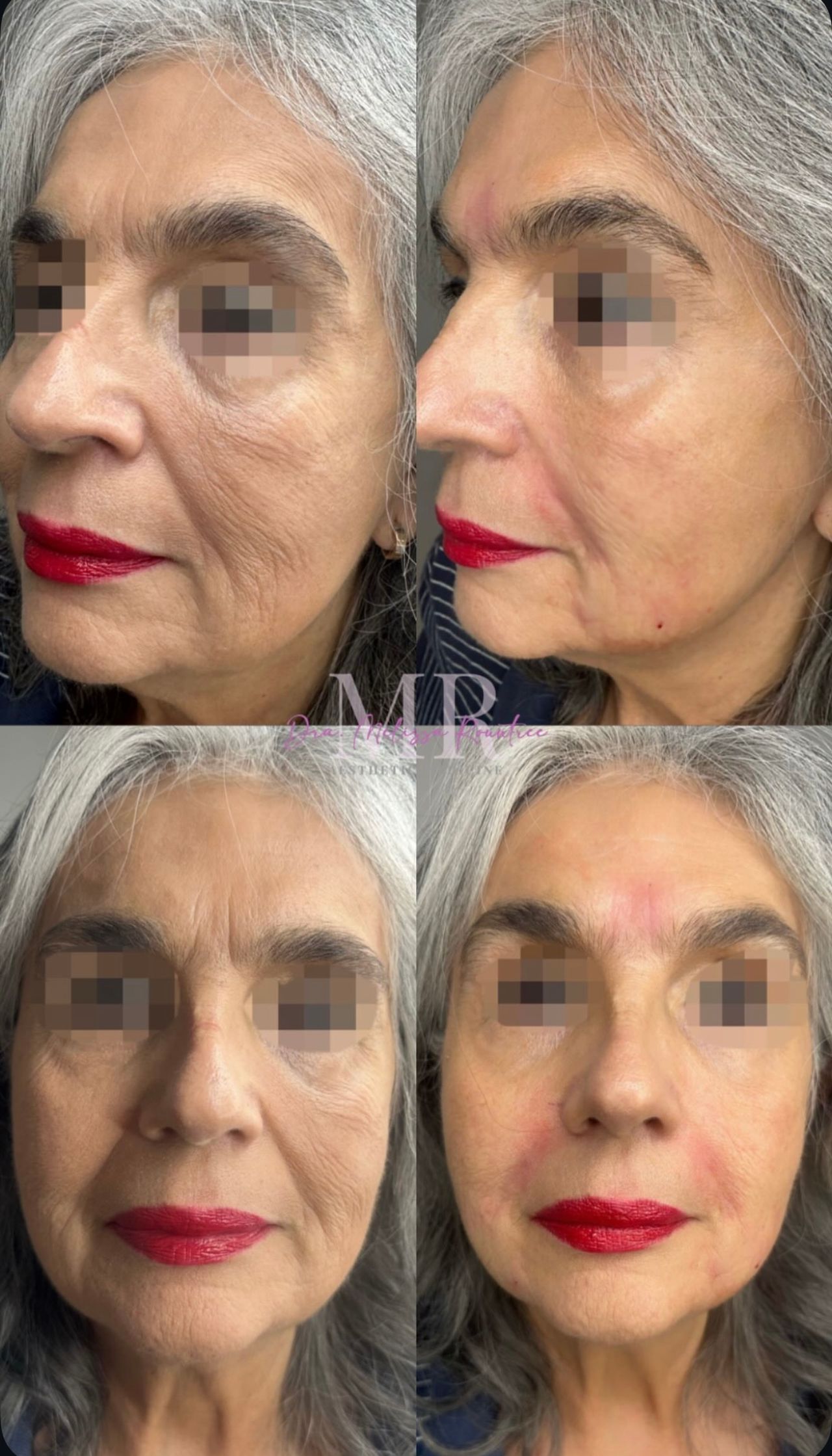 Melissa G. Rountree-27