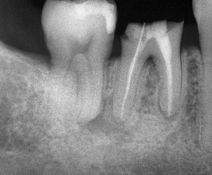 Ivan Torres Rascon-7