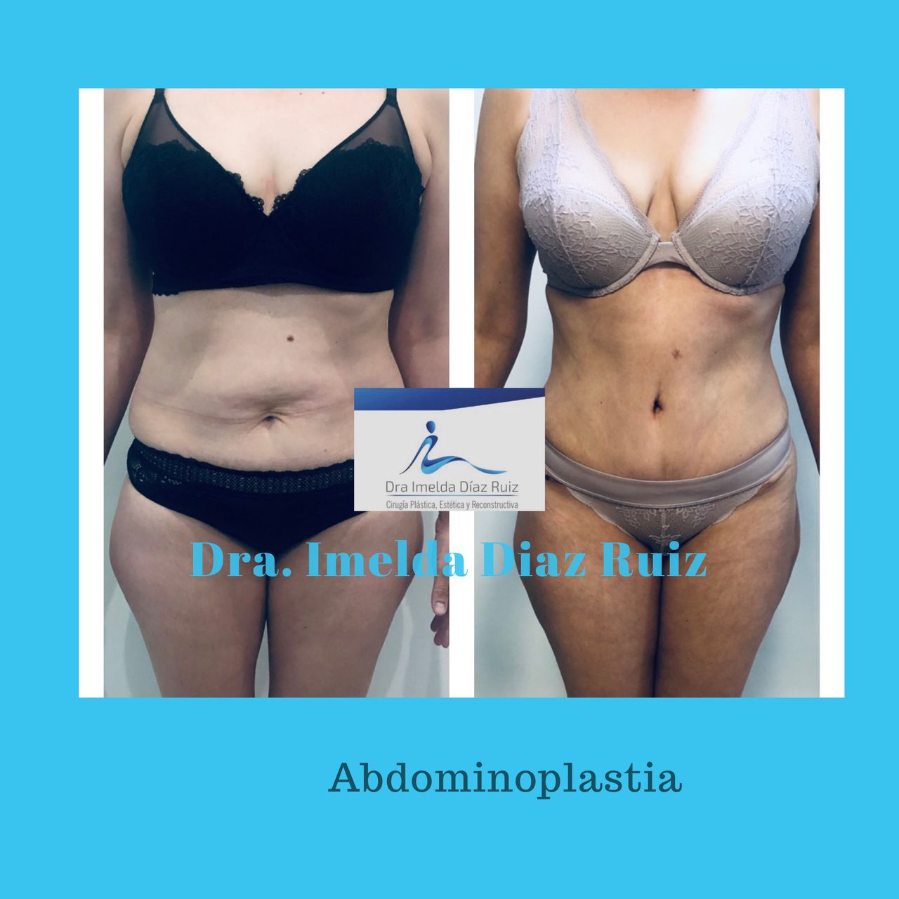 Imelda Díaz Ruiz-11