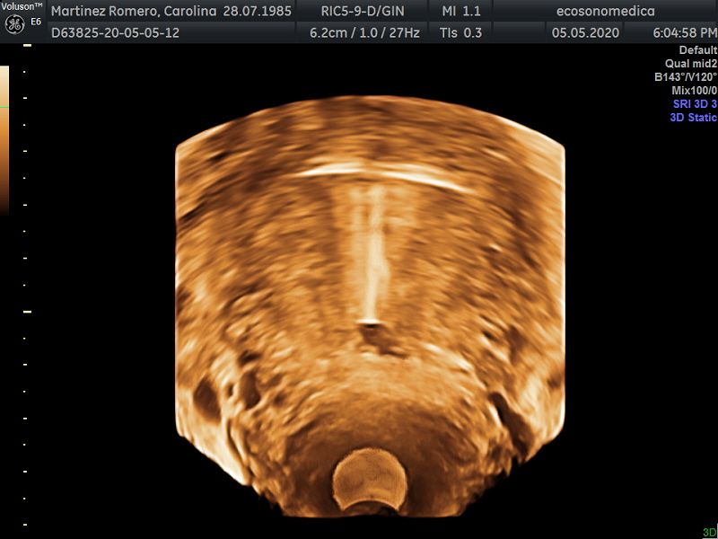 Héctor Bernardo Acevedo Manrique-21