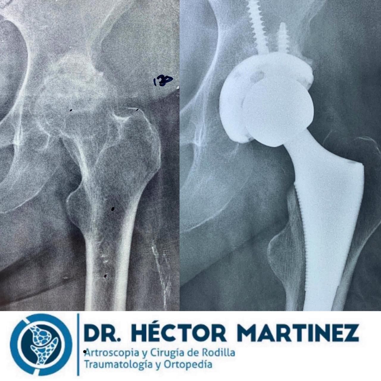 Héctor Rául Martínez Ayala-55