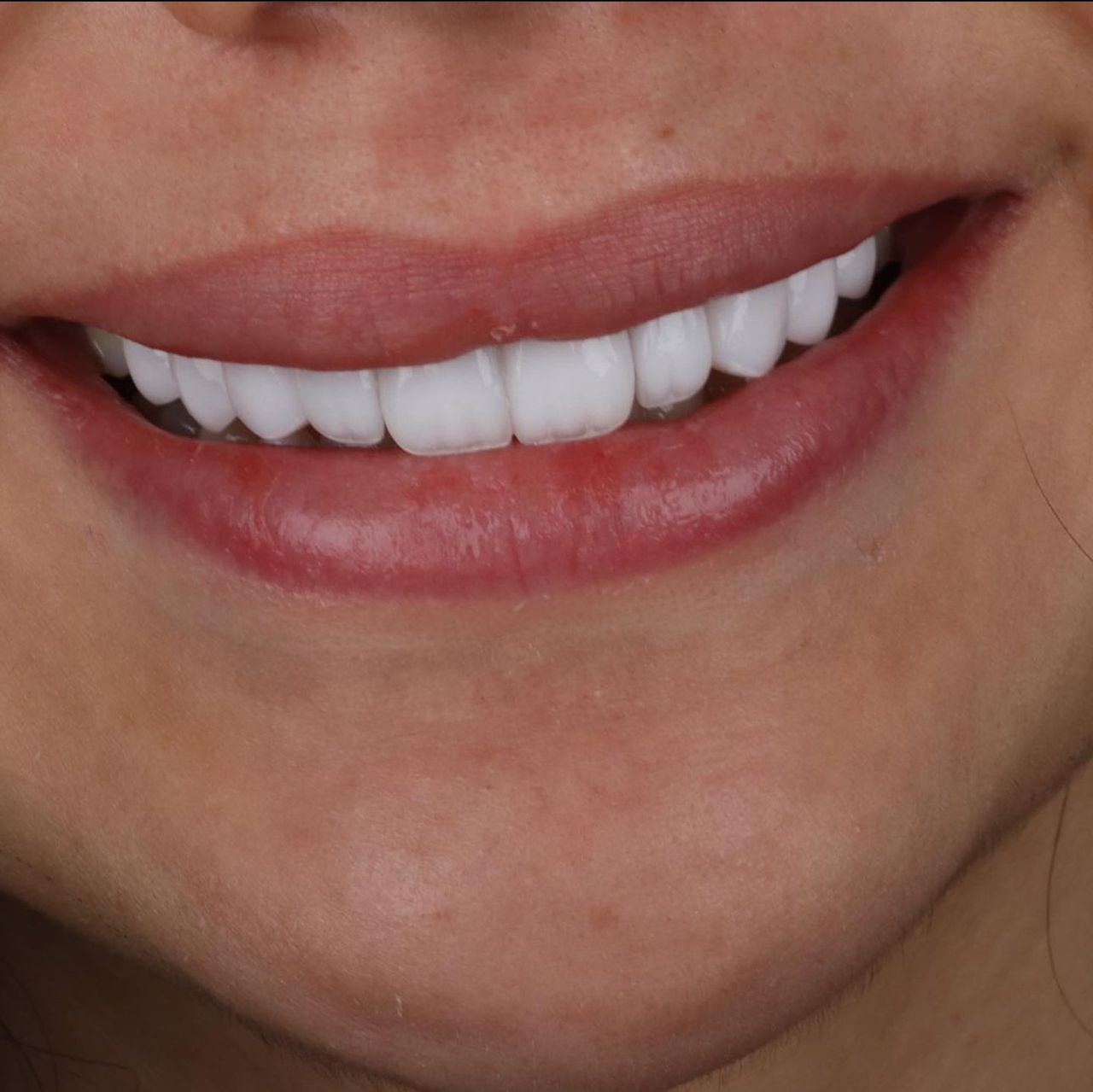 Angel Gabriel Hernández Sánchez-3