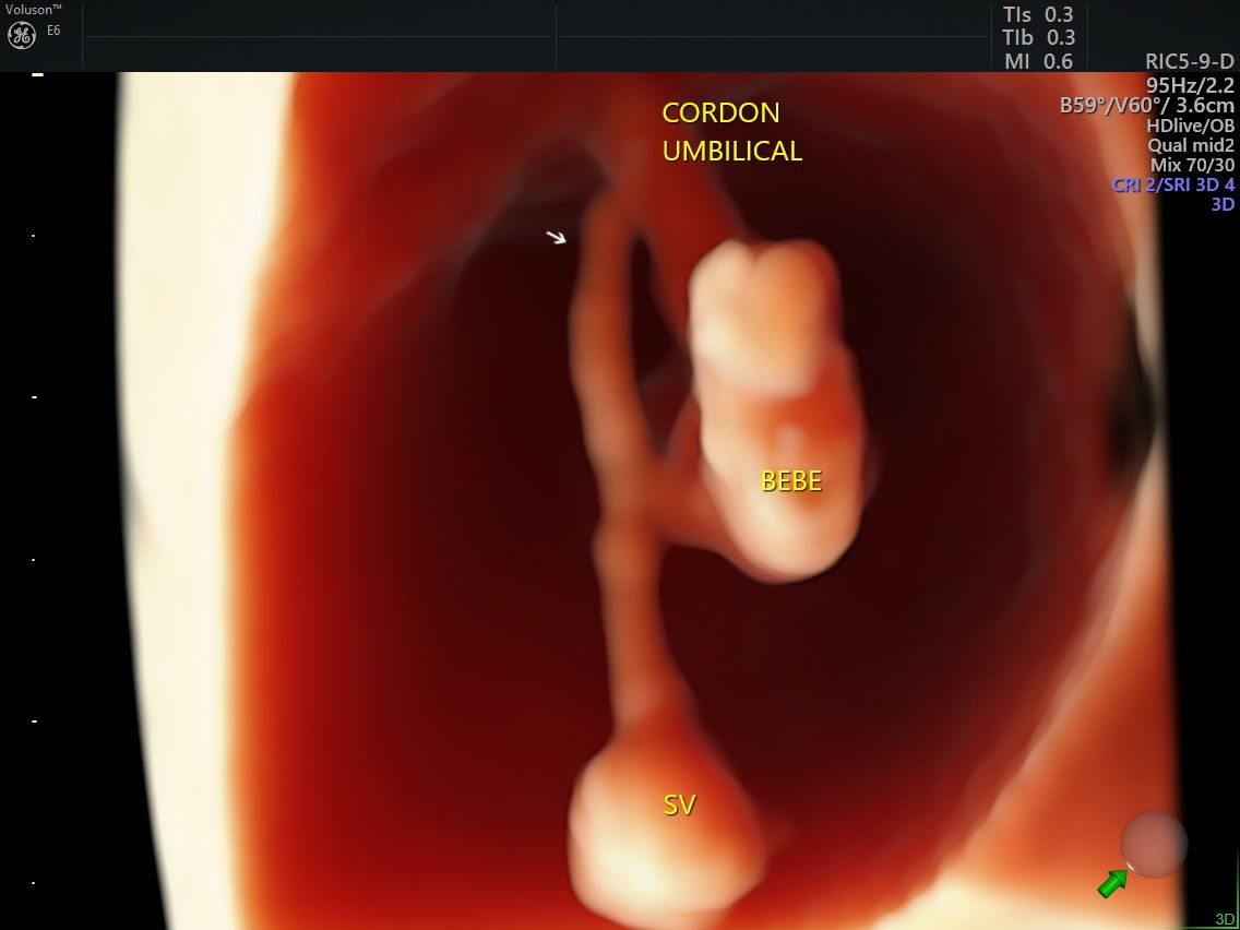 Edgardo Reyes Ponce-3