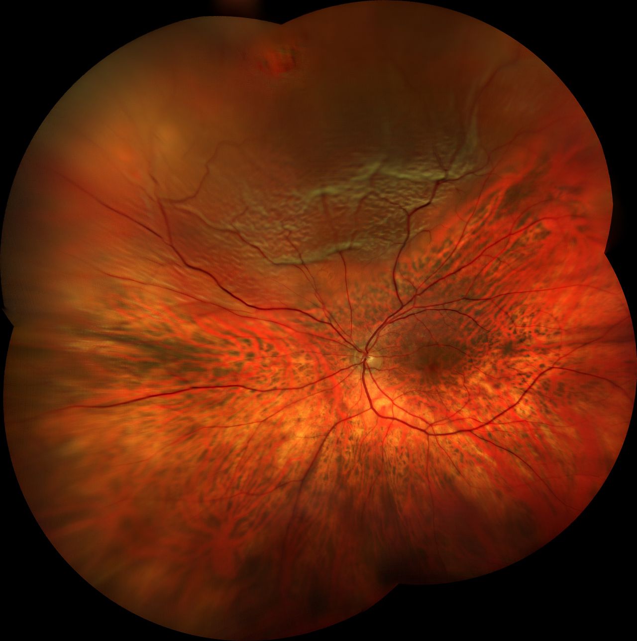 Angel Andrés Casaus Leppo-6