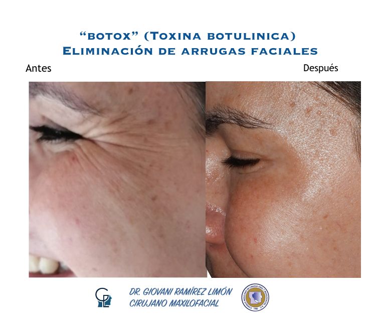 Giovani Ramírez Limón-45