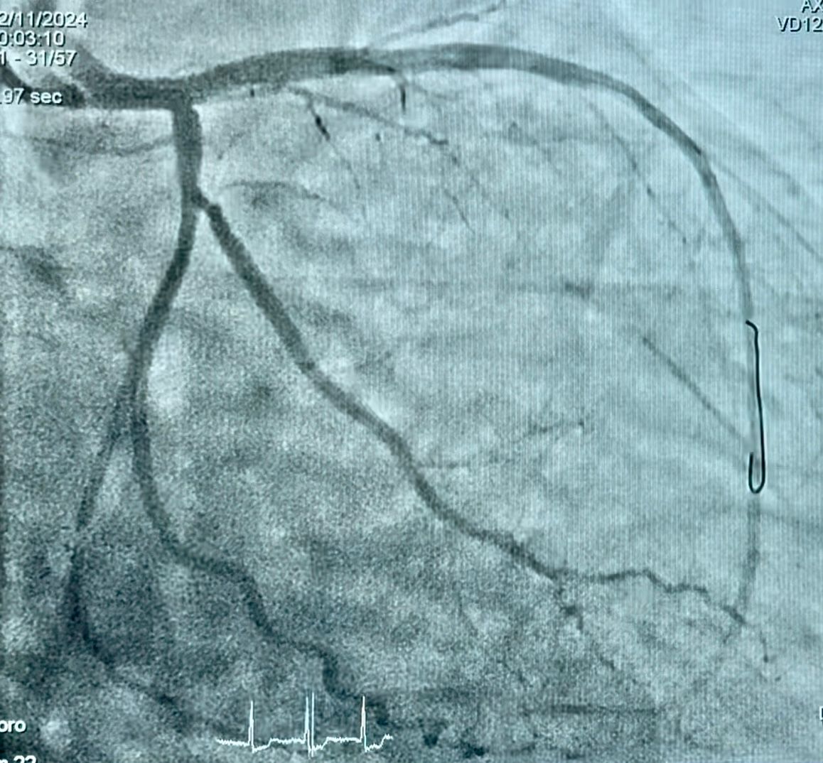 Abdón Ávila Chávez-51