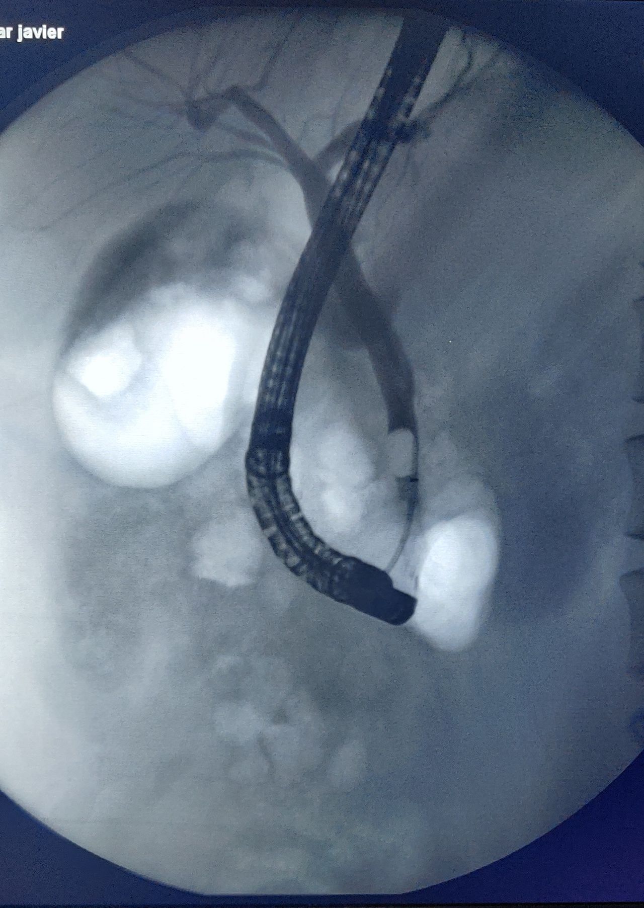 Rodrigo Robles Zavaleta-12