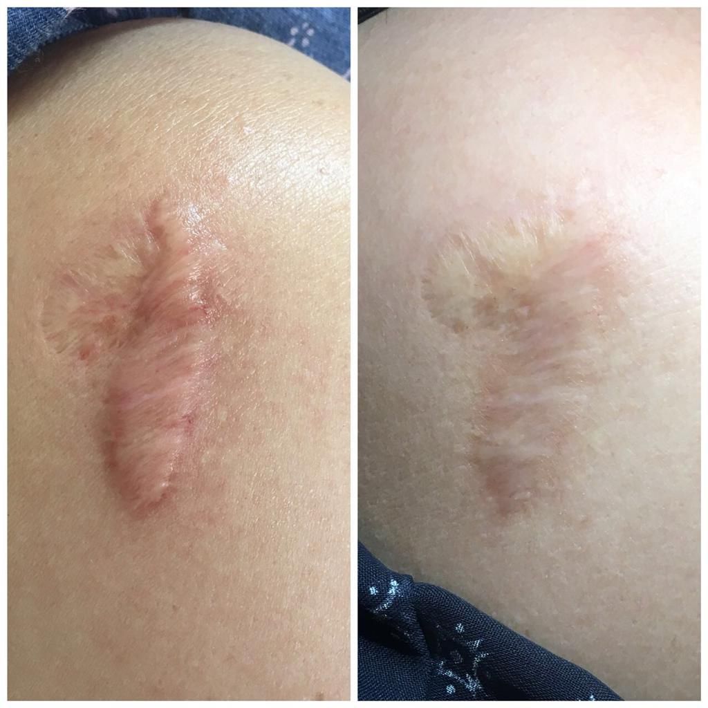 Gilliar Emmanuel Eudave De Lima-19